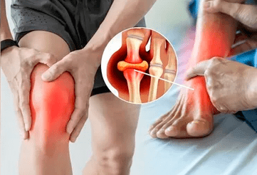 Icexin gela belauneko artikulazio eta oineko eremuan aplikatzeko eskema